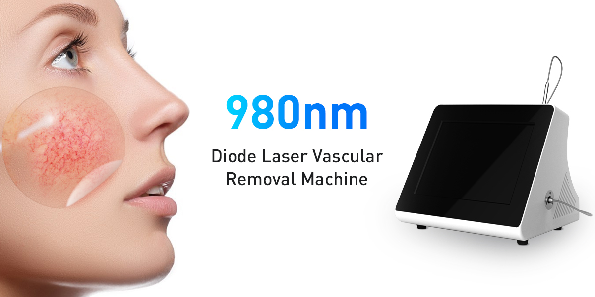 980 nm diodlaserborttagningsmaskin för spindelven