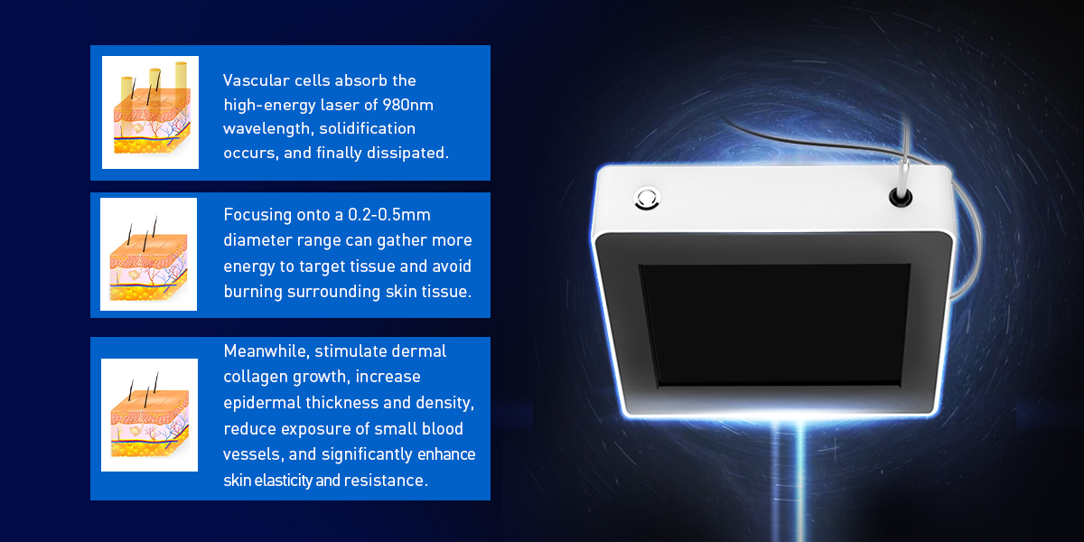 980nm diodlasermaskin 
