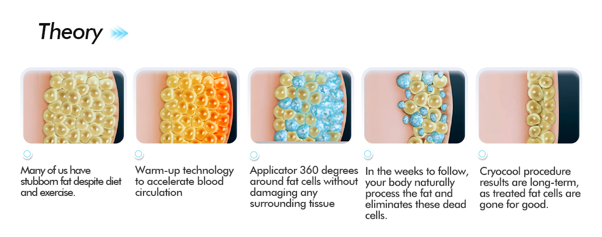 cryolipolysis fettfrysningsmaskin
