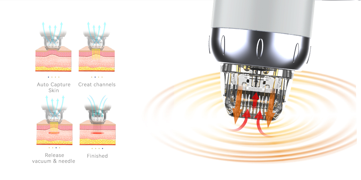 Bärbara Vacuum RF Microneedling-maskiner